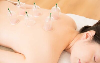Top 5 Benefits of Cupping Massage