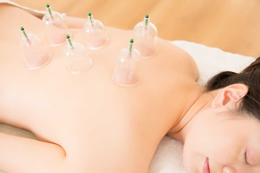 Top 5 Benefits of Cupping Massage